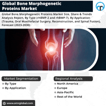 Bone Morphogenetic Proteins Market GIF - Bone Morphogenetic Proteins Market GIFs