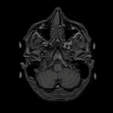 Mri Brain GIF - Mri Brain Scan GIFs