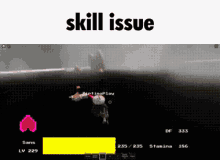 Skill Issue Issue GIF - Skill Issue Issue Skill GIFs