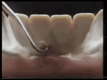 Dentist Plaque GIF - Dentist Plaque Bad Teeth GIFs