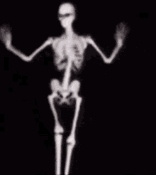 Dancing Skeleton Dancing Skeleton Gif GIF - Dancing Skeleton Dancing Skeleton Gif GIFs