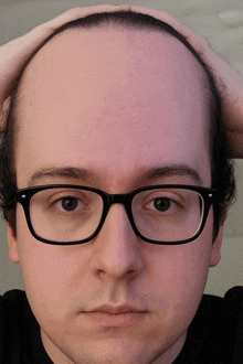 a man wearing glasses holds his head in his hands
