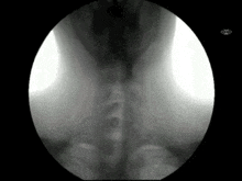 X Ray Swallowing GIF - X Ray Swallowing Drinking GIFs