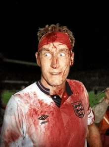 a man with blood on his face wearing a umbro shirt