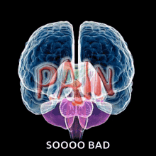 Pain Painful GIF - Pain Painful Migraine GIFs