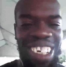 a close up of a man 's face with a beard and missing teeth smiling .