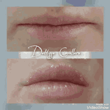 a before and after photo of a woman 's lips with the name dott.ssa cavallero on the bottom