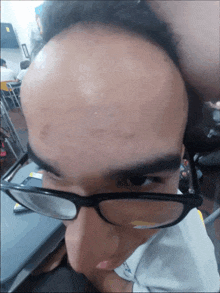 a man wearing glasses looks at the camera with his head in his hands