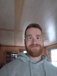 Crazy Selfie GIF - Crazy Selfie Crossed Eye GIFs