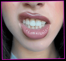 a close up of a woman 's mouth showing her teeth