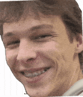 a young man with braces on his teeth smiles