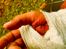 Pain Ouch GIF - Pain Ouch Handshake GIFs