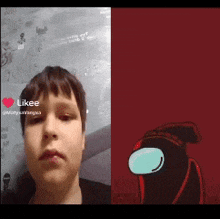 a boy with a black eye is next to a among us cartoon