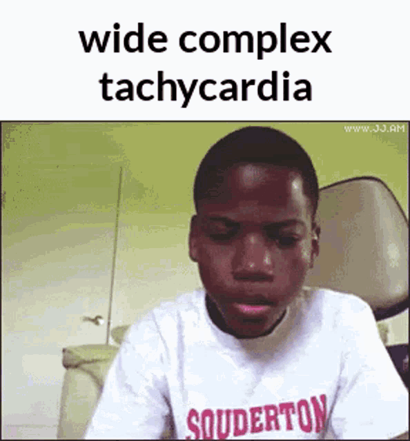 Wide Complex Tachycardia Tachycardia GIF - Wide Complex Tachycardia Wide Complex Tachycardia GIFs