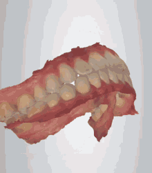 teeth trios model scan