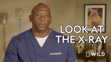 Look At The Xray Dr Terrence Ferguson GIF