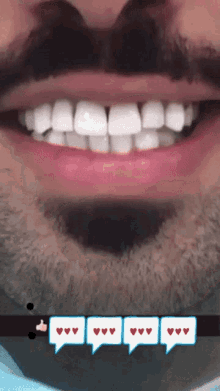 Mustapha Djihad White Teeth GIF - Mustapha Djihad White Teeth Smile GIFs