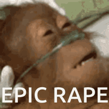 Eric Pape Orangutan GIF - Eric Pape Orangutan Sick GIFs