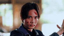 a man with a purple shirt and a black jacket has a bloody head