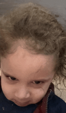 a close up of a child 's face with a scratch on the forehead
