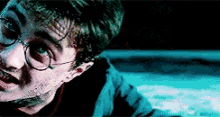 Harry Potter Hurt GIF