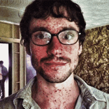 a man with glasses and a beard has spots on his face