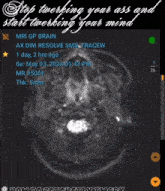 Mri Scan Brain Scan GIF - Mri Scan Brain Scan Twerk Ratchetly GIFs