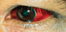 Red Eye GIF - Red Eye GIFs