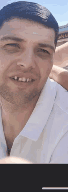 Ryan White Buck Teeth GIF - Ryan White Buck Teeth GIFs