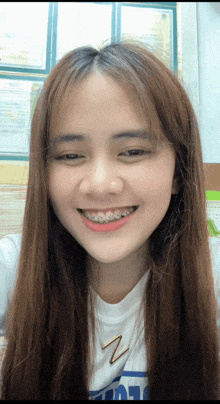 a girl with braces on her teeth is smiling and wearing a shirt with the letter z on the front