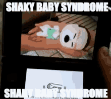 shakybabysyndrome