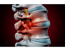 Neck Pain And Chiropractic Care Fargo Nd GIF - Neck Pain And Chiropractic Care Fargo Nd GIFs
