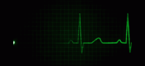 heart rate gif tumblr
