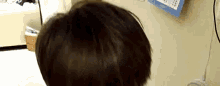 Hair Scalp GIF - Hair Scalp Head GIFs