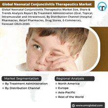 Neonatal Conjunctivitis Therapeutics Market GIF - Neonatal Conjunctivitis Therapeutics Market GIFs