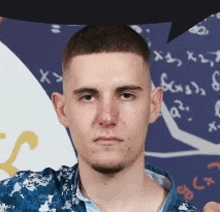 a young man with a broken nose is standing in front of a chalkboard with math equations on it .