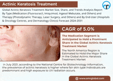 Actinic Keratosis Treatment GIF - Actinic Keratosis Treatment GIFs