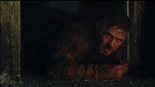 a man with blood on his face laying on the ground