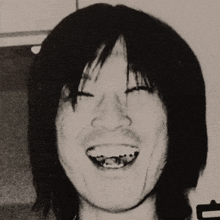 a black and white photo of a man with braces on his teeth laughing