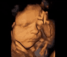 Sonography GIF - Sonography GIFs