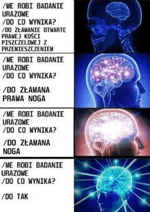 a poster showing a man 's brain and the words me robi badanie urazowe do co wynika