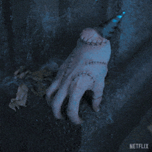 a close up of a hand with stitches and a netflix logo on the bottom