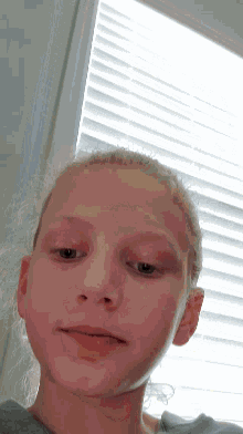 a girl with a black spot on her eye looks at the camera