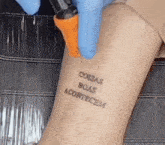 Coisas Boas Acontecem Tatuagem Apagando Laser GIF - Coisas Boas Acontecem Tatuagem Apagando Laser GIFs