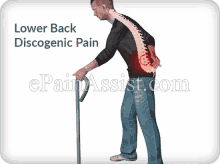 pain back