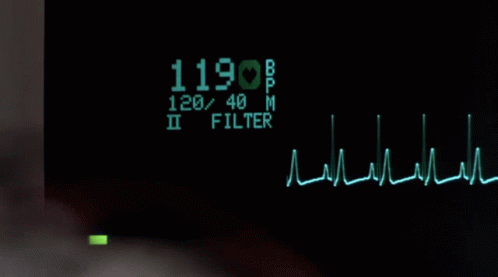 Heart Rate Monitor Gif GIFs | Tenor