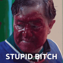 a man with blood on his face has the words stupid bitch written below him