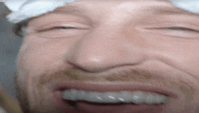 a close up of a man with a bandage on his head smiling .