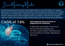 Brain Monitoring Market GIF