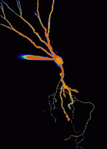 樹状細胞 GIF - Dendrite Neuron Cell GIFs